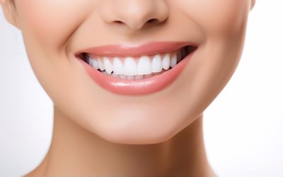 Zâmbetul perfect: tipuri de implanturi dentare și beneficii